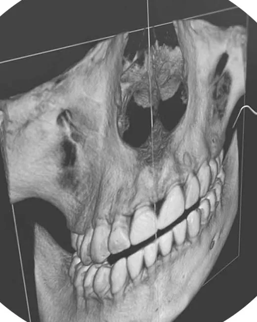 3D снимка на зъби с Planmeca в Търговище