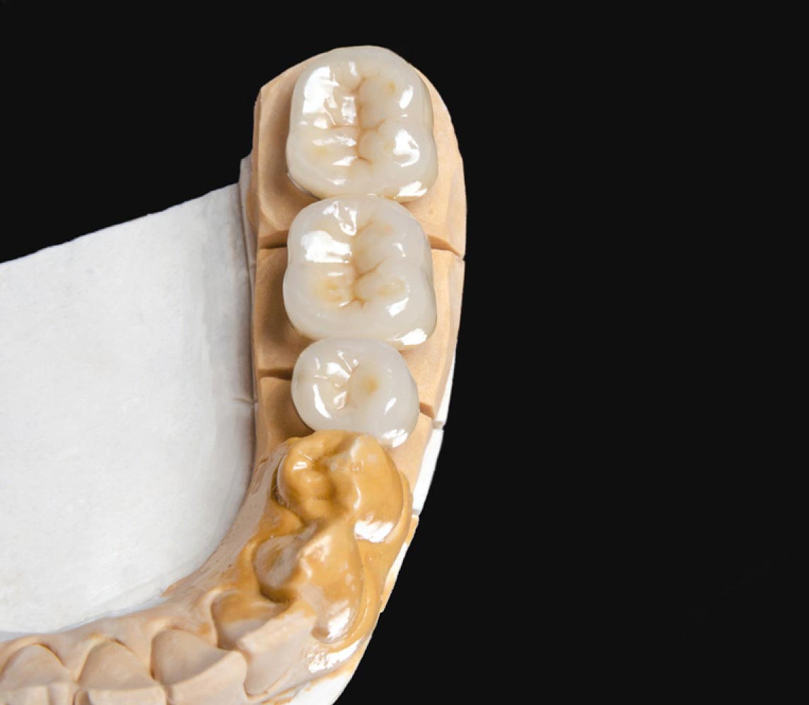 targovishte cirkoniev most