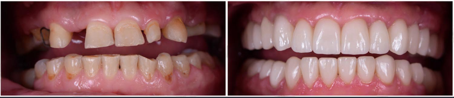zyben most pylna promqna targovishte