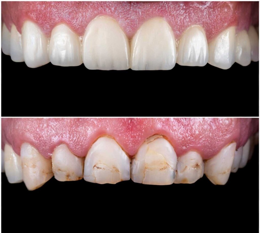 koroni i faseti targovishte