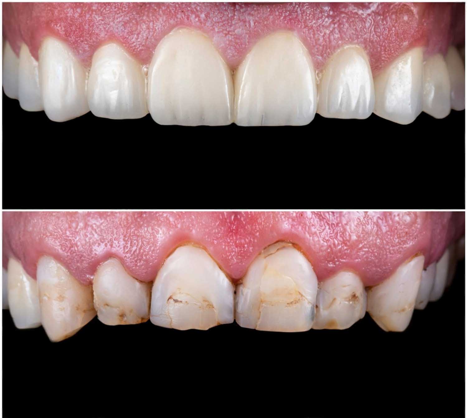 koroni i faseti targovishte