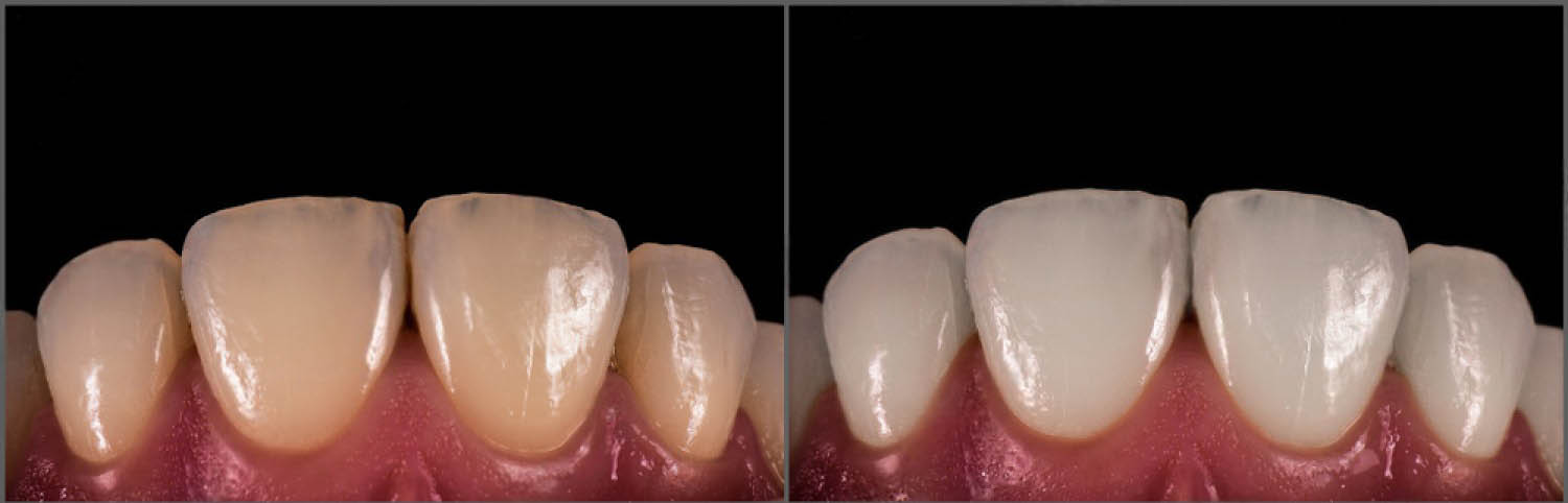 domashno izbelvane na zybi