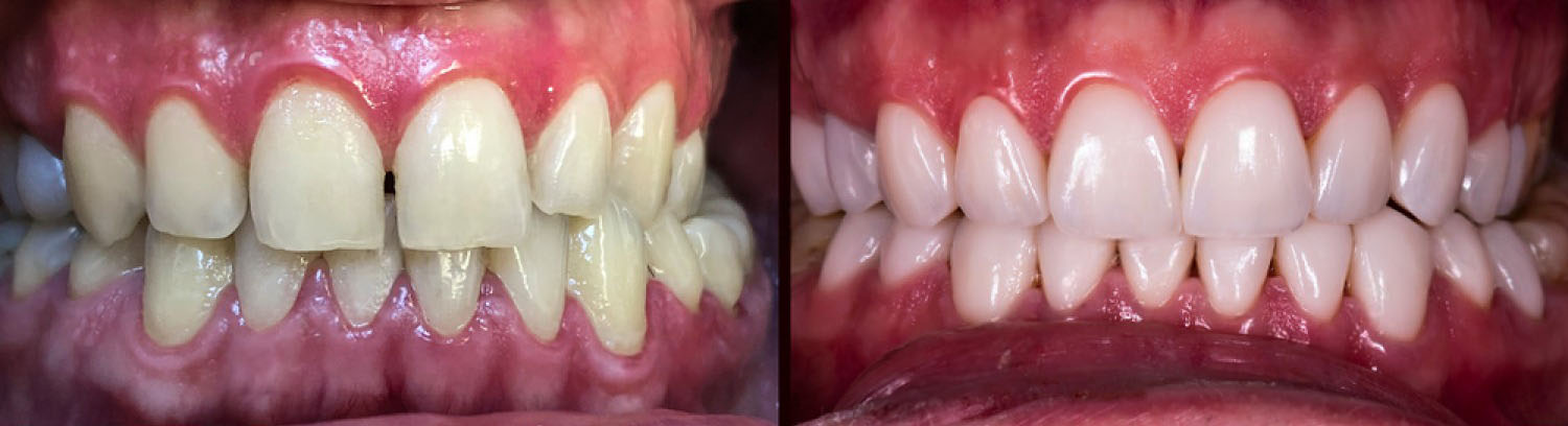 keramichni faseti targovishte