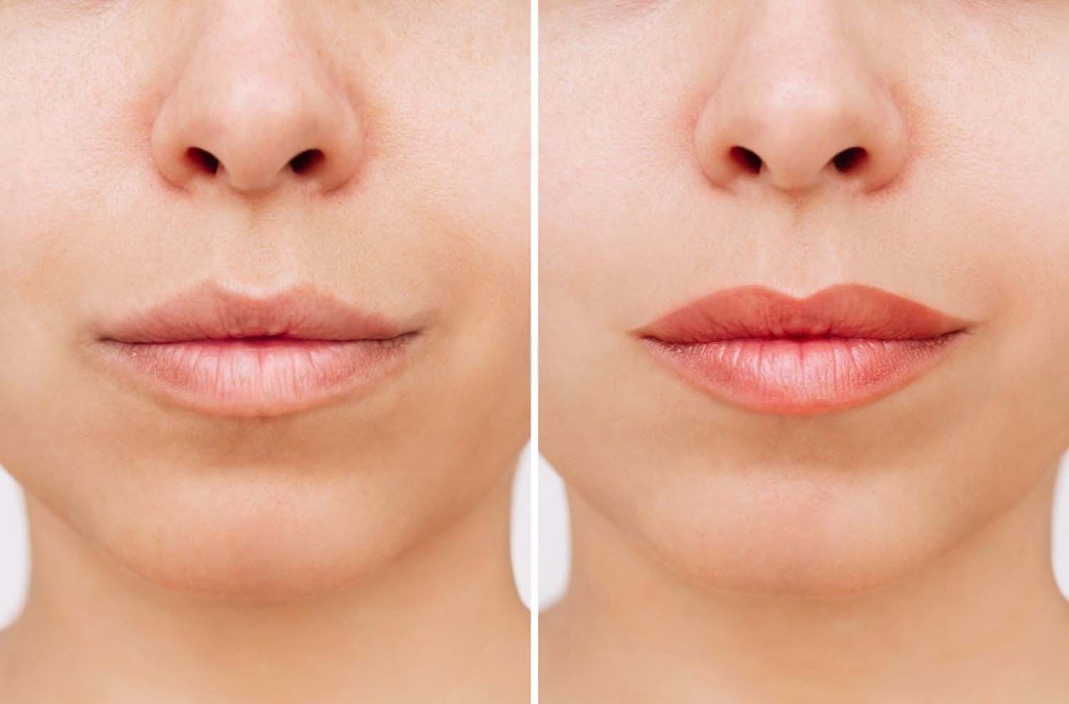 targovishte hialuron