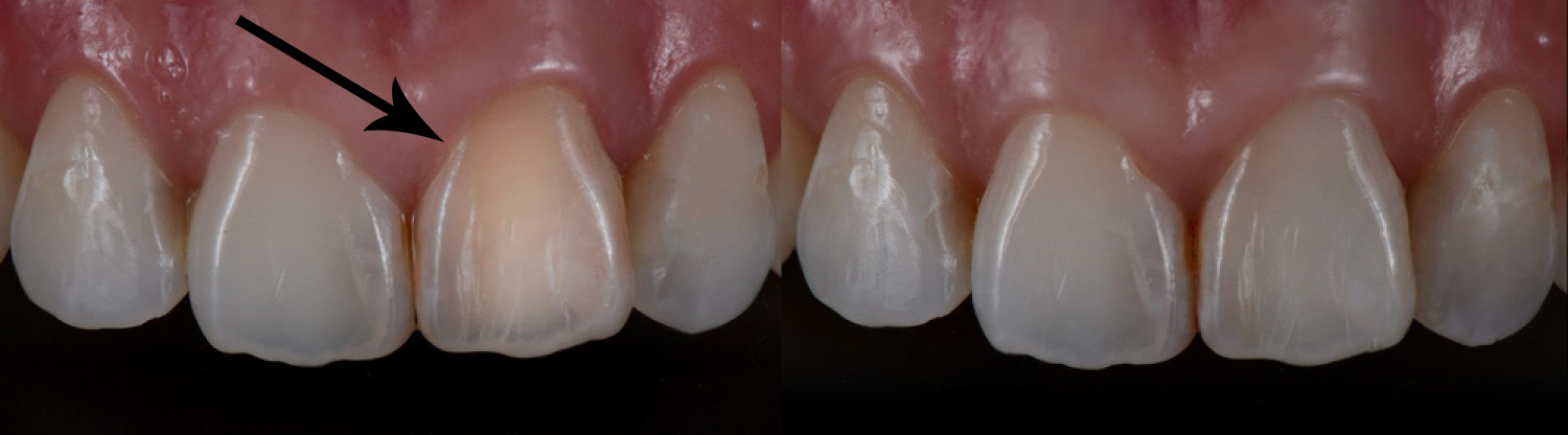 izbelvane na edin zyb targovishte